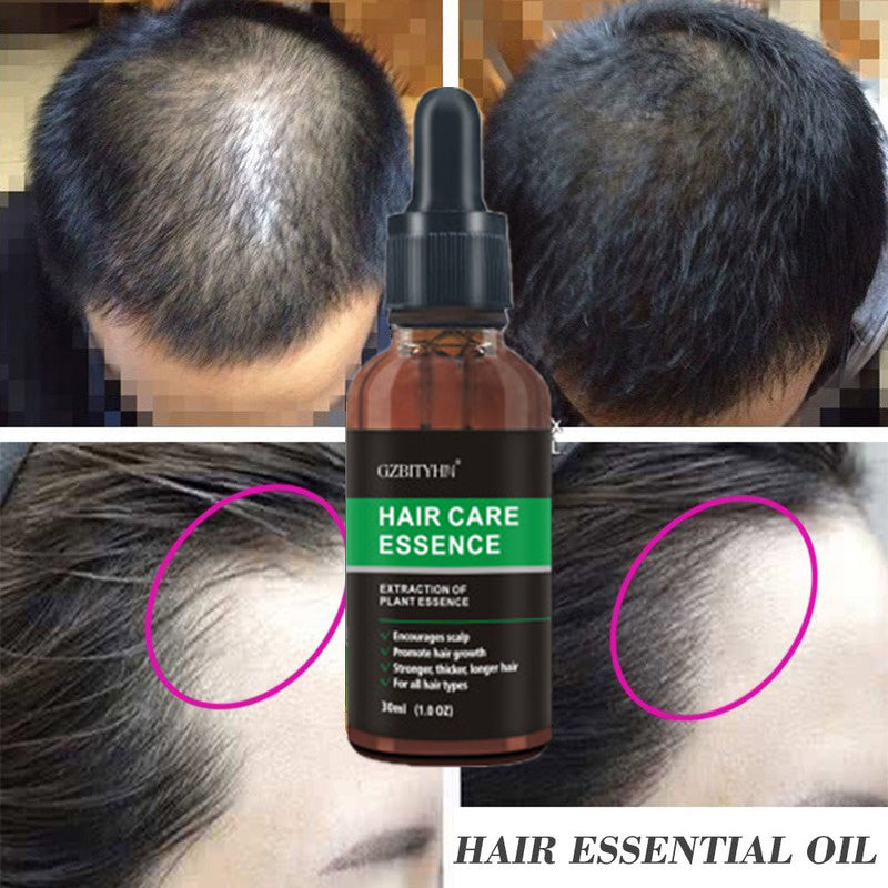 Hair Growth Oil – Nourish, Strengthen & Revitalize Your Hair
