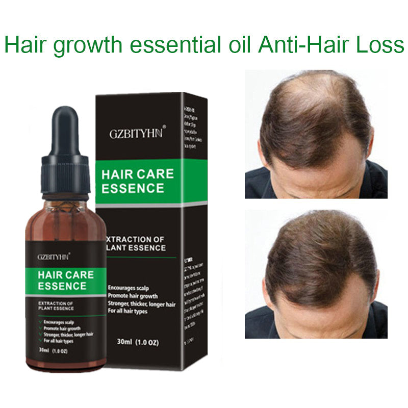 Hair Growth Oil – Nourish, Strengthen & Revitalize Your Hair