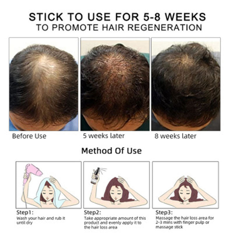 Hair Growth Oil – Nourish, Strengthen & Revitalize Your Hair